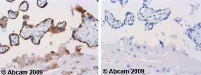Ab58504 staining human normal placenta tissue. Staining is localised to intracellular compartment (endoplasmic reticulum).Left panel: with primary antibody at 2 ug/ml. Right panel: isotype control.Sections were stained using an automated system DAKO Autostainer Plus , at room temperature. Sections were rehydrated and antigen retrieved with the Dako 3-in-1 AR buffer EDTA pH 9.0 in a DAKO PT Link. Slides were peroxidase blocked in 3% H2O2 in methanol for 10 minutes. They were then blocked with Dako Protein block for 10 minutes (containing casein 0.25% in PBS) then incubated with primary antibody for 20 minutes and detected with Dako Envision Flex amplification kit for 30 minutes. Colorimetric detection was completed with diaminobenzidine for 5 minutes. Slides were counterstained with Haematoxylin and coverslipped under DePeX. Please note that for manual staining we recommend to optimize the primary antibody concentration and incubation time (overnight incubation), and amplification may b