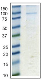 Immunoprecipitation with ab112995. Immunoprecipitation of Calnexin - ER membrane marker from HeLa cell lysate. The protein band runs around 90 kDa (predicted 68kDa) in tris-glycine SDS-PAGE. The identity of this protein was confirmed by mass spectrometry. This gel was stained with colloidal Coomassie blue G.