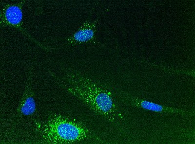ab112995 at 5µg/ml staining Calnexin - ER membrane marker in Human fibroblasts cells by Immunocytochemistry (4% paraformaldehyde fixed and 0.1% Triton X-100 permeabilized) followed by Alexa Fluor® 488 goat anti-mouse IgG (H+L) used at a 1/1000 dilution for 1h(green).