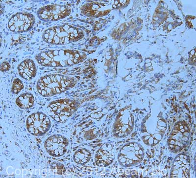 IHC image of ab112995 staining in human colon formalin fixed paraffin embedded tissue section, performed on a Leica BondTM system using the standard protocol F. The section was pre-treated using heat mediated antigen retrieval with sodium citrate buffer (pH6, epitope retrieval solution 1) for 20 mins. The section was then incubated with ab112995, 1µg/ml, for 15 mins at room temperature and detected using an HRP conjugated compact polymer system. DAB was used as the chromogen. The section was then counterstained with haematoxylin and mounted with DPX. For other IHC staining systems (automated and non-automated) customers should optimize variable parameters such as antigen retrieval conditions, primary antibody concentration and antibody incubation times.