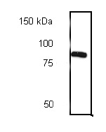Anti-Calnexin antibody - ER Marker (ab10286) at 1/1000 dilution + MCF7 cellsSecondaryGoat anti rabbit at 1/10000 dilution