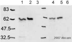 All lanes : Anti-Calnexin antibody - ER Marker (ab10286) at 1/4000 dilutionLane 1 : HeLa (Total cell lysate)Lane 2 : HeLa (Membrane fraction)Lane 3 : HeLa (Cytoplasmic fraction)Lane 4 : MDA-MB231 (Total cell lysate)Lane 5 : MDA-MB231 (Membrane fraction)Lane 6 : MDA-MB231 (Cytoplasmic fraction)SecondaryHRP conjugated donkey anti-rabbitdeveloped using the ECL techniquePerformed under reducing conditions.