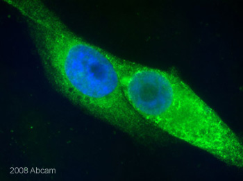 Paraformaldehyde fixed HeLa cells stained with ab10286. For further details please refer to the customer Abreview.