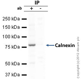 Calnexin - ER membrane marker was immunoprecipitated using 0.5mg Hela whole cell extract, 5µg of Rabbit polyclonal to Calnexin - ER membrane marker and 50µl of protein G magnetic beads (+). No antibody was added to the control (-). The antibody was incubated under agitation with Protein G beads for 10min, Hela whole cell extract lysate diluted in RIPA buffer was added to each sample and incubated for a further 10min under agitation.Proteins were eluted by addition of 40µl SDS loading buffer and incubated for 10min at 70oC; 10µl of each sample was separated on a SDS PAGE gel, transferred to a nitrocellulose membrane, blocked with 5% BSA and probed with ab22595.Secondary: Goat polyclonal to mouse IgG light chain specific (HRP) at 1/5000 dilution.Band: 80kDa: Calnexin - ER membrane marker.