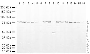 All lanes : Anti-Calnexin antibody - ER Membrane Marker (ab22595) at 1/250 dilutionLane 1 : NIH 3T3 (Mouse embryonic fibroblast cell line) Whole Cell Lysate (ab7179)Lane 2 : MEF1 (Mouse embryonic fibroblast cell line) Whole Cell Lysate (ab46770)Lane 3 : Brain (Mouse) Tissue Lysate (ab27253)Lane 4 : Liver (Mouse) Tissue Lysate (ab7935)Lane 5 : Heart (Mouse) Tissue Lysate (ab27255)Lane 6 : Kidney (Mouse) Tissue Lysate (ab27254)Lane 7 : Pancreas (Mouse) Tissue Lysate (ab29363)Lane 8 : Testis (Mouse) Tissue Lysate - normal tissue (ab4027)Lane 9 : Skeletal Muscle (Mouse) Tissue Lysate (ab29711)Lane 10 : Spinal Cord (Mouse) Tissue Lysate (ab50253)Lane 11 : Ovary (Mouse) Tissue Lysate (ab35808)Lane 12 : PC12 (Rat adrenal pheochromocytoma cell line) Whole Cell Lysate (ab50957)Lane 13 : Brain (Rat) Tissue Lysate (ab7942)Lane 14 : Liver (Rat) Tissue Lysate (ab27256)Lane 15 : Heart (Rat) Tissue Lysate (ab7940)Lane 16 : Kidney (Rat) Whole Cell Lysate - normal tissue (ab29480)Lysates/proteins at 10