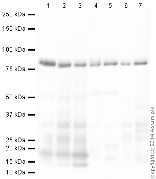All lanes : Anti-Calnexin antibody - ER Membrane Marker (ab140818) at 1 µg/mlLane 1 : HeLa (Human epithelial carcinoma cell line) Whole Cell LysateLane 2 : NIH 3T3 (Mouse embryonic fibroblast cell line) Whole Cell LysateLane 3 : PC12 (Rat adrenal pheochromocytoma cell line) Whole Cell LysateLane 4 : Brain (Mouse) Tissue LysateLane 5 : Brain (Rat) Tissue LysateLane 6 : Liver (Mouse) Tissue LysateLane 7 : Liver (Rat) Tissue LysateLysates/proteins at 20 µg per lane.SecondaryGoat Anti-Chicken IgY H&L (HRP) (ab6877) at 1/3000 dilutiondeveloped using the ECL techniquePerformed under reducing conditions.