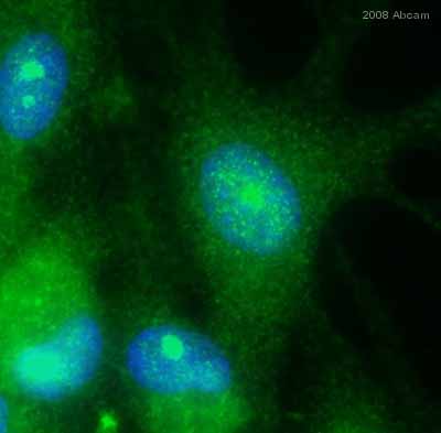 ab28258 staining human HUVEC cells by ICC/IF.  Cells were PFA fixed and permeablized in 0.5% Triton X-100 prior to blocking in 1% serum for 16 hours at 4°C.  The primary antibody was diluted 1/100 and incubated with the sample for 2 hours at 25°C.  A FITC conjugated goat anti-rabbit antibody, diluted 1/100, was used as the secondary.See Abreview
