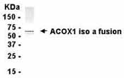 Anti-ACOX1 antibody (ab37740) at 1/2000 dilution + ACOX1 iso a fusion protein at 0.5 µgSecondaryGoat anti-IgY-HRP at 1/1000 dilution