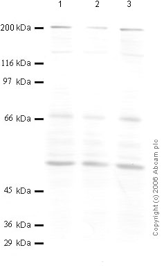 All lanes : Anti-Calpain 15 antibody - Amino end, Zinc Finger Domain (ab38950) at 1/1000 dilutionLane 1 : SF RD Lysate at 1:10Lane 2 : TPA treated RD Lysate at 1:10Lane 3 : IL1-beta treated RD Lysate at 1:10Lysates/proteins at 30 µl per lane.