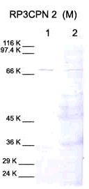 All lanes : Anti-Calpain 2 antibody (ab28259) at 1/1000 dilutionLane 1 : Calpain controlLane 2 : Cell lysates from human chodrosarcoma (treated with II1a)