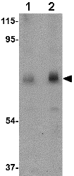 Lane 1 :  Anti-Calpain 6 antibody (ab76974) at 0.5 µg/mlLane 2 :  Anti-Calpain 6 antibody (ab76974) at 1 µg/mlLane 1 : rat lung tissue lysate Lane 2 : rat lung tissue lysate 