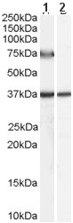 All lanes : Anti-ACOX2 antibody (ab59516) at 0.5 µg/mlLane 1 : Human Liver lysate (35µg protein in RIPA buffer) without blocking with the immunizing peptideLane 2 : Human Liver lysate (35µg protein in RIPA buffer) with blocking with the immunizing peptidedeveloped using the ECL technique