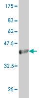Western blot against tagged recombinant protein immunogen using ab56474 ACOX2 antibody at 1ug/ml.