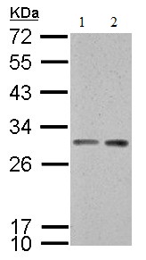 All lanes : Anti-14-3-3 sigma antibody (ab151504) at 1/3000 dilutionLane 1 : Neuro2A whole cell lysateLane 2 : GL261 whole cell lysateLysates/proteins at 30 µg per lane.