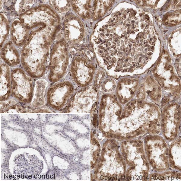 IHC image of Calreticulin staining in a section of formalin-fixed paraffin-embedded human normal kidney*. The section was pre-treated using pressure cooker heat mediated antigen retrieval with sodium citrate buffer (pH6) for 30mins, and incubated overnight at +4°C with ab195511 at 1µg/ml. DAB was used as the chromogen (ab103723), diluted 1/100 and incubated for 10min at room temperature. The section was counterstained with haematoxylin and mounted with DPX. The inset negative control image is taken from an identical assay without primary antibody.For other IHC staining systems (automated and non-automated) customers should optimize variable parameters such as antigen retrieval conditions, primary antibody concentration and antibody incubation times.*Tissue obtained from the Human Research Tissue Bank, supported by the NIHR Cambridge Biomedical Research Centre