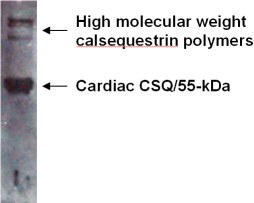 Anti-Calsequestrin antibody (ab15611) at 1/500 dilution + purified dog cardiac calsequestrinCalsequestrin always forms high molecular weight aggregates which are unavoidable so they always show up on the top of the gel. This is common for all known anti-CSQ antibodies and has been described in many papers in the past.