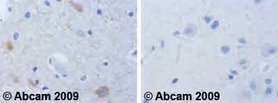 Ab62215 staining human normal occipital cortex. Staining is localised to nuclear and cytoplasmic compartments.Left panel: with primary antibody at 4 ug/ml. Right panel: isotype control.Sections were stained using an automated system DAKO Autostainer Plus , at room temperature. Sections were rehydrated and antigen retrieved with the Dako 3-in-1 antigen retrieval buffer EDTA pH 9.0 in a DAKO PT Link. Slides were peroxidase blocked in 3% H2O2 in methanol for 10 minutes. They were then blocked with Dako Protein block for 10 minutes (containing casein 0.25% in PBS) then incubated with primary antibody for 20 minutes and detected with Dako Envision Flex amplification kit for 30 minutes. Colorimetric detection was completed with diaminobenzidine for 5 minutes. Slides were counterstained with Haematoxylin and coverslipped under DePeX. Please note that for manual staining we recommend to optimize the primary antibody concentration and incubation time (overnight incubation), and amplification ma