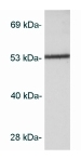 Anti-CaMKI antibody (ab3551) at 2 µg/ml + Cell lysate prepared from AtT20 cells