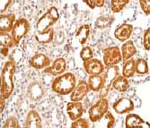 ab68234 at 1/100-1/250 dilution staining CaMKI in human kidney tissue sections.