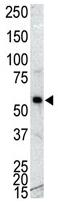 Anti-CaMKI gamma antibody (ab37972) at 1/100 dilution + NCI-H460 cell lysateSecondaryHRP-anti-rabbit