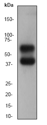 Anti-CaMKII antibody [EP1829Y] (ab52476) at 1/20000 dilution (unpurified) + Mouse brain lysate at 10 µgSecondaryGoat anti-rabbit HRP labeled at 1/2000 dilution