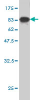 Western blot against tagged recombinant protein immunogen using ab54926 CaMKII beta antibody at 1ug/ml.
