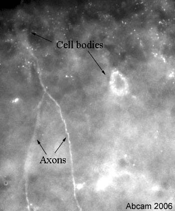 Immunofluorescent staining in the rat hippocampal neurons using ab22131 CAMKIIb antibody. This picture was taken using a 40X objective. The staining is observed in the axons and cell bodies of some hippocampal neurons. NB: apart from the hippocampus, most brain areas did not show any staining in this naïve animal. ab22131 was used at 1/100 incubated for 2 days at room temperature. Secondary antibody used was anti-rabbit Alexa Fluor 488 at 1/1000 incubated for 2 hours at room temperature. Rat brain tissue was perfusion fixed with 4% PFA followed by overnight post-fixation in the same fixative, cryoprotected in 20% sucrose and frozen in OCT. 30µm coronal sections were cut on a cyrostat and immunohistochemistry performed by the 'free floating' technique.