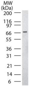 Anti-CaMKII beta antibody (ab22131) at 1/2000 dilution + Rat brain lysate