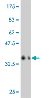 Western blot against tagged recombinant protein immunogen using ab54931 CaMKII delta antibody at 1ug/ml.