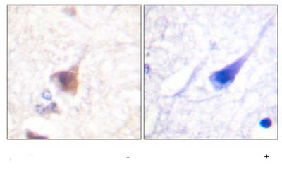 ab59424, at a 1/50 dilution, staining paraffin embedded human brain tissue sections by Immunohistochemistry in the absence (left image) or presence (right image) of the phosphopeptide.