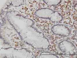 CaMKK antibody (ab57913) used in immunohistochemistry at 1ug/ml on formalin fixed and paraffin embedded human stomach.