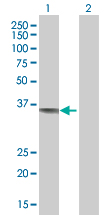 All lanes : Anti-CAMLG antibody (ab67714) at 1/500 dilutionLane 1 : CAMLG transfected 293T cell lysateLane 2 : non transfected 293T cell lysateLysates/proteins at 25 µg per lane.SecondaryGoat Anti-Mouse IgG (H&L)-HRP Conjugate at 1/2500 dilution