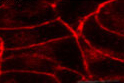 ab3558 at a 1:1000 dilution staining Rat CB1 in transfected AtT20 cells by immunocytochemistry.