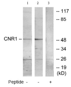 All lanes : Anti-Cannabinoid Receptor I antibody (ab75165) at 1/500 dilutionLane 1 : extracts from COS-7cells Lane 2 : extracts from HT-29 cellsLane 3 : extracts from HT-29 cells with immunising peptide at 10ug Lysates/proteins at 30 µg per lane.