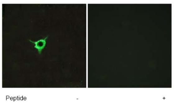 Immunofluorescence analysis of LOVO cells, using ab75165 at 1/500 dilution.