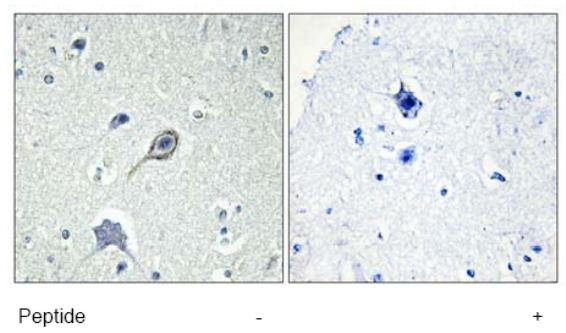Immunohistochemistry analysis of paraffin-embedded human brain tissue using ab75165 at 1/50 dilution.