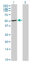 All lanes : Anti-Cannabinoid Receptor I antibody (ab167366) at 1 µg/mlLane 1 : Cannabinoid Receptor I transfected 293T cell line lysateLane 2 : Non-transfected 293T cell line lysateLysates/proteins at 15 µl per lane.SecondaryGoat anti-Mouse IgG HRP at 1/2500 dilution