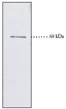Anti-Cannabinoid Receptor I antibody (ab23703) + Human cerebellum at 30 µg