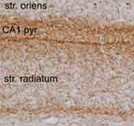 ab23703 staining Cannabinoid Receptor I in rat brain tissue by Immunohistochemistry (Frozen sections). After fixation in 4% PFA in PBS (pH 7.4), brains were cryoprotected in 30% sucrose in PBS at +4°C, frozen, and thereafter kept at -80°C until used. For the immunostaining, brains were cryosectioned in 30 µm slices, collected in PBS (pH 7.4), and processed in a free-floating system. Slices were first incubated in the blocking solution (BS) containing 2% bovine serum albumin, 2% goat serum, and 0.1% Triton X-100 in PBS (pH 7.4) for 1 hour at room temperature, and thereafter with the primary antibody for 24–48 hours at +4°C in BS at a 1/1000 dilution. After washing in PBS, slices were incubated with the biotin-conjugated secondary antibody (1/4000) in BS, rinsed with PBS, and incubated with the avidin-peroxidase conjugate in BS for 1 hour at room temperature. The staining was detected using 3,3-diaminobenzidinetetrahydrochloride as a chromogen.