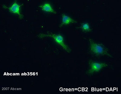 ab3561 staining Cannabinoid Receptor II in murine BV2 cells by Immunocytochemistry/ Immunofluorescence. Cells were stimulated with 10 uM ADP for 15 minutes at 37°C, 5%CO2 then washed 3X with PBS and fixed with 2% formaldehyde for 15 minutes at room temperature. A blocking step was performed for 1 hour at room temperature with 5% FBS/PBS/0.01% Triton-X-100. ab3561 used at a 1/500 dilution for 1 hour at room temperature then washed 3X PBS. The secondary was an Alexa Fluor 488 conjugated antibody, used at a 1/250 for 1 hour at room temperature, washed 3X PBS then mounted in Vectashield containing DAPI.