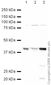 All lanes : Anti-Cannabinoid Receptor II antibody (ab45942) at 1 µg/mlLane 1 : Spinal Cord (Human) Tissue LysateLane 2 : Spinal Cord (Rat) Tissue Lysate Lane 3 : Thymus (Mouse) Tissue Lysate - normal tissue (ab29285)Lysates/proteins at 10 µg per lane.SecondaryIRDye 680 Conjugated Goat Anti-Rabbit IgG (H+L) at 1/10000 dilutionPerformed under reducing conditions.