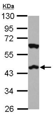 Anti-Cannabinoid Receptor II antibody (ab151414) at 1/1000 dilution + PC3 whole cell lysate at 30 µg