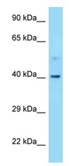 Anti-Cannabinoid Receptor II antibody (ab123056) at 1 µg/ml + 721_B cell lysate at 10 µg