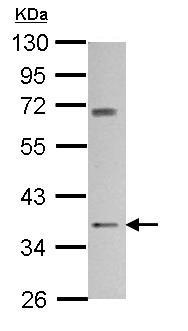 Anti-Cannabinoid Receptor II antibody - C-terminal (ab153747) at 1/1000 dilution + NT2D1 whole cell lysate at 30 µg