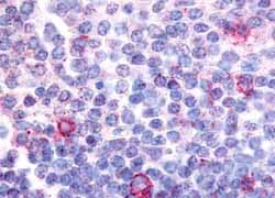 Immunohistochemical analysis of formalin fixed and paraffin embedded Human tonsil tissue, germinal center and mantle zone labelling Cannabinoid Receptor II with ab150569 at 17 ug/ml after heat-induced antigen retrieval.