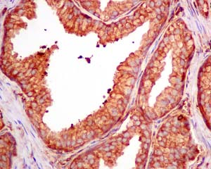 Immunohistochemical analysis of paraffin-embedded prostate tissue, labeling CAP1 with ab155079 at 1/100 dilution.