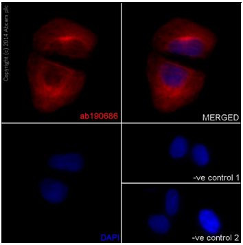 Immunofluorescence analysis of 4% paraformaldehyde-fixed SH-SY5Y cells labeling CAPON with ab190686 at 1/50 dilution. Goat anti-rabbit IgG (Alexa Fluor® 555) at 1/200 dilution was used as the secondary antibody (red). Slide is counter stained with Dapi (blue).