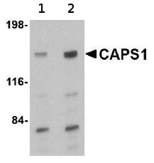 Lane 1 :  Anti-CAPS1 antibody (ab69795) at 0.5 µg/mlLane 2 :  Anti-CAPS1 antibody (ab69795) at 1 µg/mlLane 1 : Rat brain tissue lysateLane 2 : Rat brain tissue lysateLysates/proteins at 15 µg per lane.