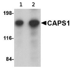 Lane 1 :  Anti-CAPS1 antibody (ab69797) at 0.25 µg/mlLane 2 :  Anti-CAPS1 antibody (ab69797) at 0.5 µg/mlLane 1 : Rat brain tissue lysateLane 2 : Rat brain tissue lysateLysates/proteins at 15 µg per lane.