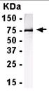 Anti-CAPZA1 antibody (ab15735) at 1/2000 dilution + E coli derived fusion proteinSecondaryHRP conjugated goat anti IgY at 1/1000 dilution